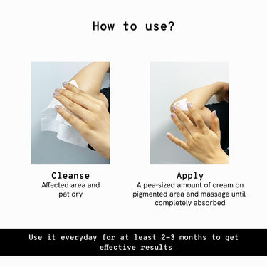Be Bodywise Pigmentation Cream 100gm | 2.5% Lactic Acid, 2% Urea, Retinol & Kojic Acid | Reduces Tan, Pigmentation & Evens Skin Tone | Treats Dark Patches & Rough Skin on Elbows, Knees, Back of Neck & Thighs | For Daily Use